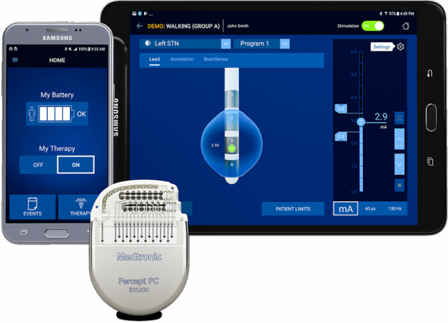 Medtronic Launches Adbs Trial In Parkinsons Disease Patients