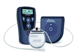 Vercise DBS system