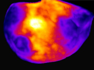 This density map of the cerebral cortex of a mouse shows which neurons get activated when the animal explores a new environment. The lit up region at the center (white and yellow) represents neurons associated with the mouse’s whiskers.