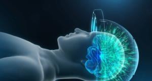 exablate neuro singapore