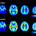 Brain Scans – no annotations (1)