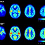 Brain Scans – no annotations