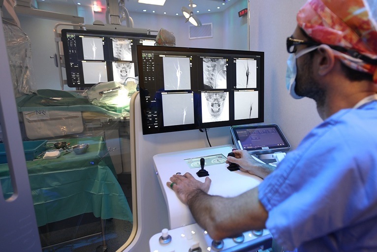 Robocath successfully performs first carotid stenting in France with R ...