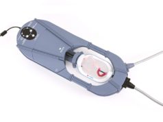 Study indicates aneurysm embolisation strategy can be optimised using 3D-printed, patient-specific models