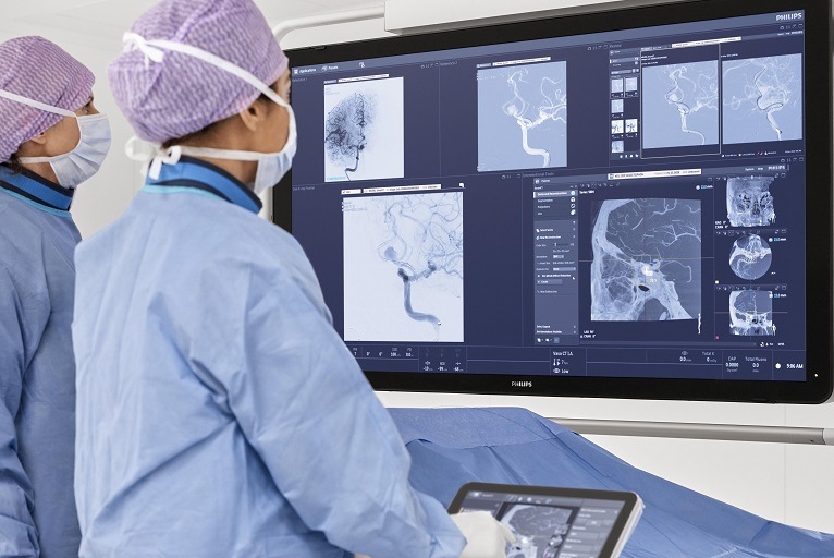 First US and French patients enrolled in Philips’ WE-TRUST study