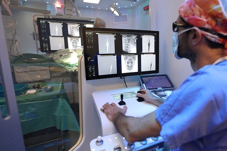 First robotic-assisted intracranial implant of Cerus Endovascular contour  intrasaccular device - NeuroNews International