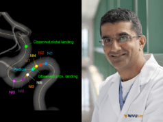 Study finds “eye-opening” variability across physician estimations of flow-diverter deployment