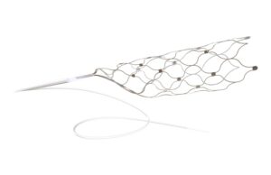 Synchron launches patient registry for Stentrode brain-computer interface