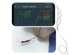 Rapid Medical completes successful stroke procedures with “world’s first” robotic thrombectomy device