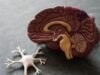US study describes new potential mechanism underlying brain aneurysm rupture risks