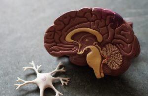 Female sex, disease severity and vasospasm among predictors of post-SAH delayed cerebral infarction risk