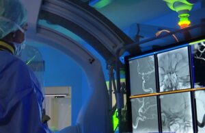 New Siemens-WSO partnership to tackle stroke’s “disastrous disease trajectory”