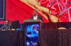 COAST is clear: study finds coiling safe in small brain aneurysms