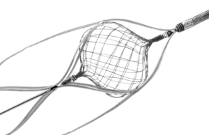 Vesalio introduces NeVa NET 4mm for acute ischaemic stroke due to large vessel occlusion