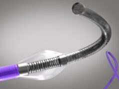 The Ottawa Hospital first to adopt Vena Medical’s BDAC device