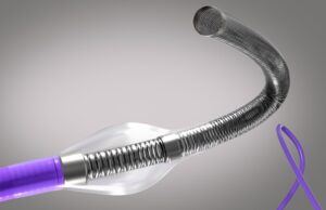 The Ottawa Hospital first to adopt Vena Medical’s BDAC device