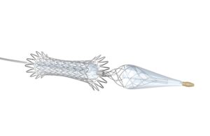 Contego Medical’s Neuroguard IEP system receives US FDA approval for carotid revascularisation