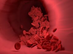 Reversible thrombolytic could alleviate US “tribalism” around tPA and help redefine stroke treatment