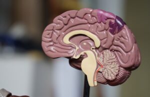 Researchers introduce model for predicting post-coiling aneurysm recanalisation with “high discriminative power”