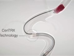 Imperative Care secures US FDA clearance for Zoom 7X catheter alongside first patient cases