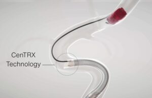 Imperative Care secures US FDA clearance for Zoom 7X catheter alongside first patient cases
