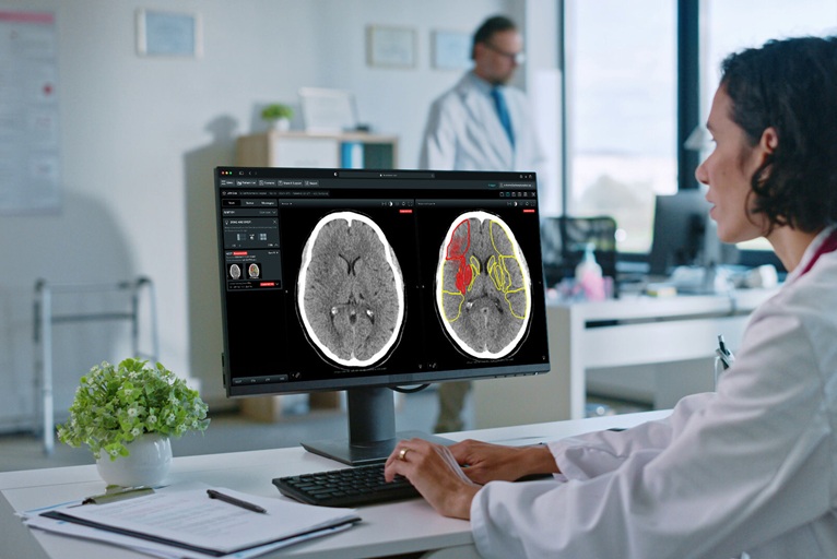 Oxford-Based Brainomix Joins Elite Future Fifty Scale-Up Cohort