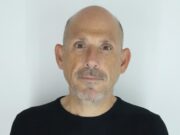 Intracranial dAVFs: beyond haemorrhage to the cognitive dimension