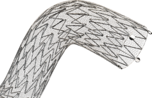 C-GUARDIANS pivotal trial results published