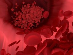 Researchers outline potential for new blood biomarker to become ‘troponin for the brain’