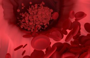 Researchers outline potential for new blood biomarker to become ‘troponin for the brain’