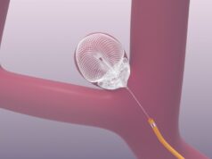 Galaxy submits final PMA module for Seal device in wide-neck bifurcation aneurysms