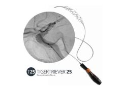 Rapid Medical announces US FDA clearance of Tigertriever 25 alongside first clinical cases