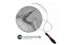 Rapid Medical announces US FDA clearance of Tigertriever 25 alongside first clinical cases