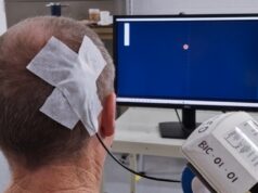 CorTec’s Brain Interchange BCI system enables stroke patient to control computer with thought alone