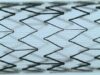 CGUARDIANS II shows positive 30-day outcomes for carotid stent use in TCAR procedures