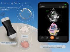 Longeviti launches ClearFit AI and brain ultrasound interface to advance neurological disorder solutions