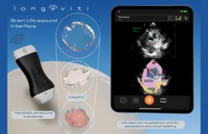 Longeviti launches ClearFit AI and brain ultrasound interface to advance neurological disorder solutions