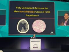 “The low-hanging fruit is gone”: larger trials and more proactive treatment key to further advancing stroke thrombectomy