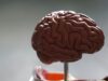 New AI-guided technique may improve delivery of brain tumour therapy