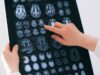 Hyperfine completes enrolment in study intended to support use of Swoop system with contrast agents
