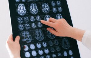 Hyperfine completes enrolment in study intended to support use of Swoop system with contrast agents
